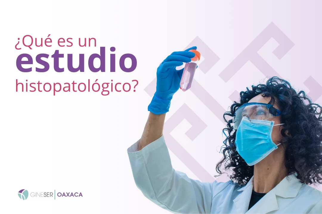 ¿Qué es un estudio Histopatológico?